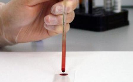 Медикам удалось определить группу крови долгожителей