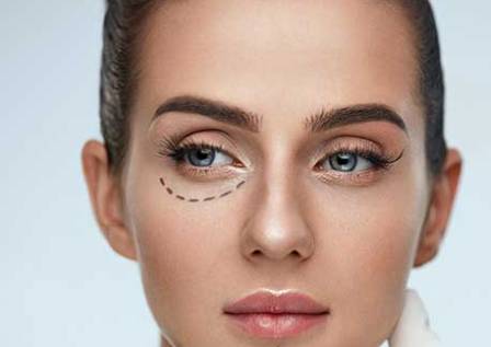 Когда нужна пластика нижних век? Когда нужна пластика нижних век?