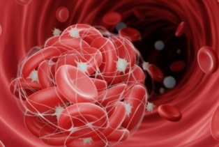Проблемы со свертываемостью крови: что такое тромбоцитопения