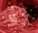 Проблемы со свертываемостью крови: что такое тромбоцитопения
