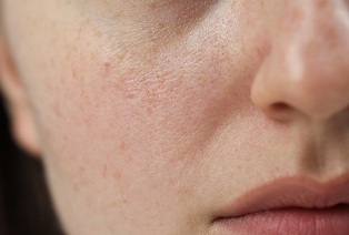 Впереди похолодание: как нам подготовить кожу лица и рук Впереди похолодание: как нам подготовить кожу лица и рук