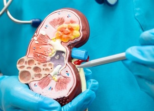 Опасное для жизни заболевание почек: сколько людей болеет Опасное для жизни заболевание почек: сколько людей болеет